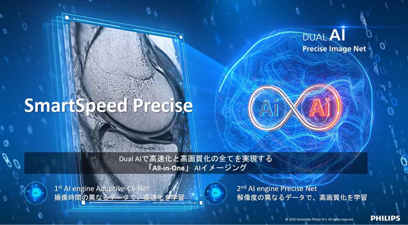Smart Speed Precise