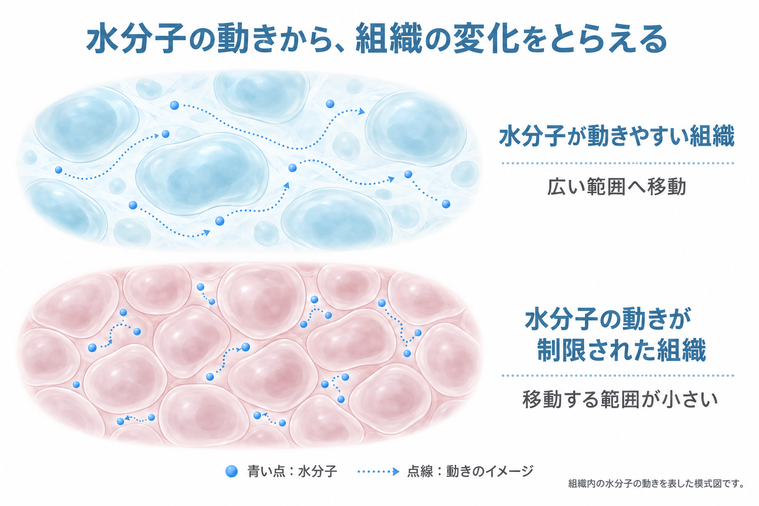 DWIBS法の原理（正常組織は水の動きが大きい、異常細胞は水の動きが小さい）